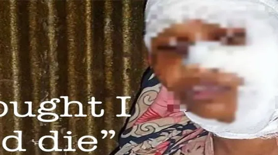 “I Thought I Would Die”  Physical Evidence of Atrocities Against the Rohingya
